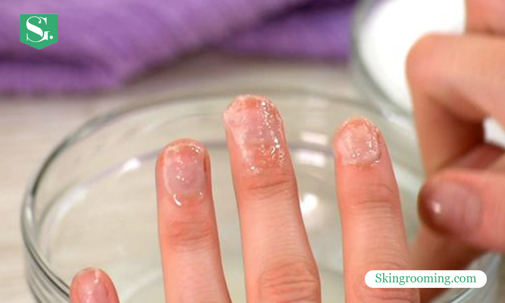 How-to-Remove-Acrylic-Nails-with-Hot-Water